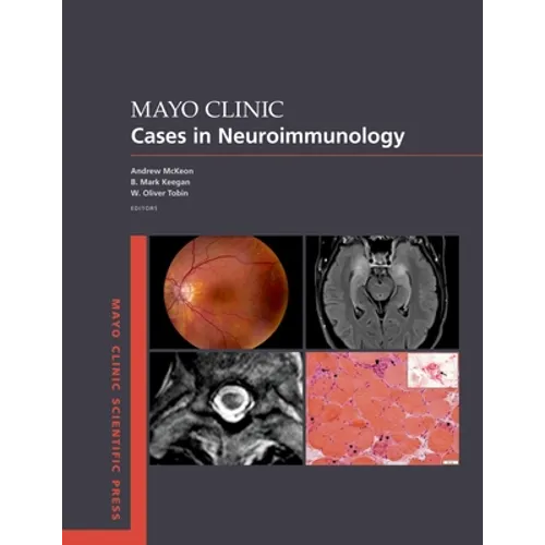 Mayo Clinic Cases in Neuroimmunology