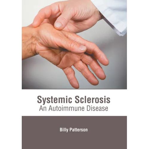Systemic Sclerosis: An Autoimmune Disease