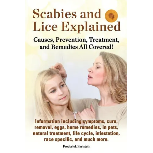 Scabies and Lice Explained. Causes, Prevention, Treatment, and Remedies All Covered! Information Including Symptoms, Removal, Eggs, Home Remedies, in