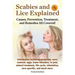 Scabies and Lice Explained. Causes, Prevention, Treatment, and Remedies All Covered! Information Including Symptoms, Removal, Eggs, Home Remedies, in