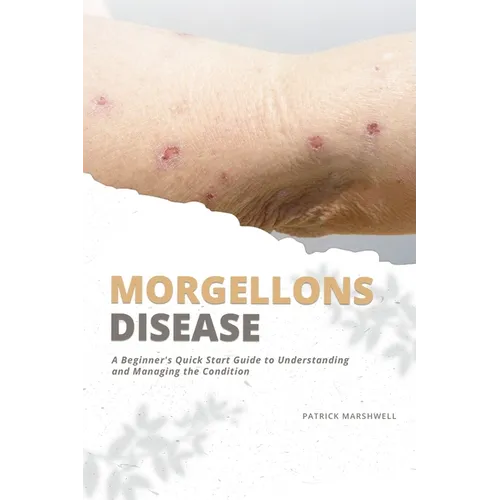 Morgellons Disease: A Beginner's Quick Start Guide to Understanding and Managing the Condition