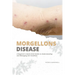 Morgellons Disease: A Beginner's Quick Start Guide to Understanding and Managing the Condition