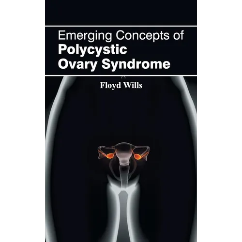 Emerging Concepts of Polycystic Ovary Syndrome
