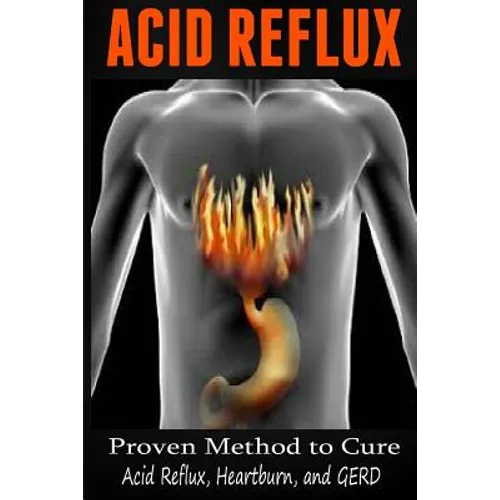 Acid Reflux: Proven Methods to Cure Acid Reflux, Heartburn, and GERD