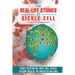 The Real-Life Stories Of Sickle Cell - A Global Collaboration