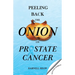 Peeling Back the Onion on Prostate Cancer