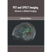 Pet and Spect Imaging: Advances in Medical Imaging