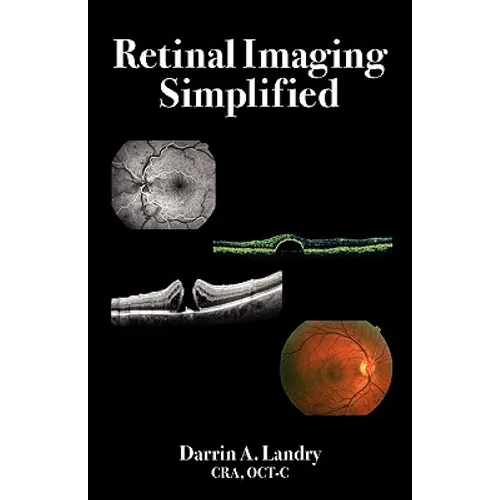 Retinal Imaging Simplified
