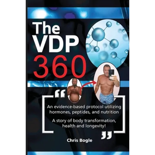 The VDP360