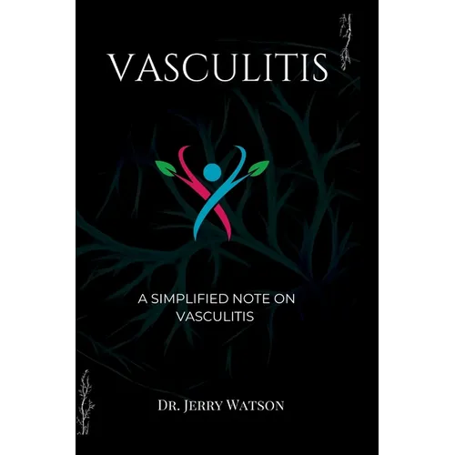 Vasculitis: A simplified note on vasculitis