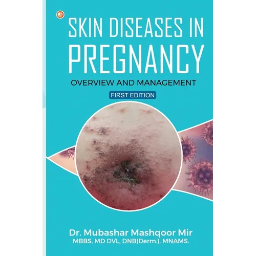 Skin Diseases in Pregnancy: Overview and Management