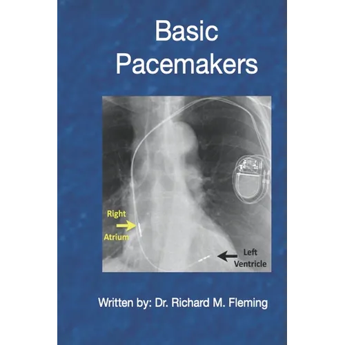Basic Pacemakers