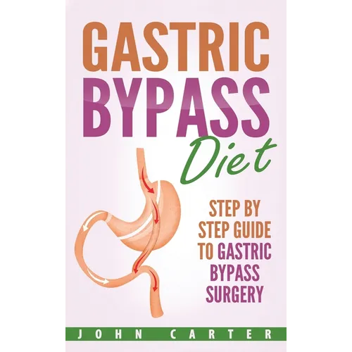 Gastric Bypass Diet: Step By Step Guide to Gastric Bypass Surgery