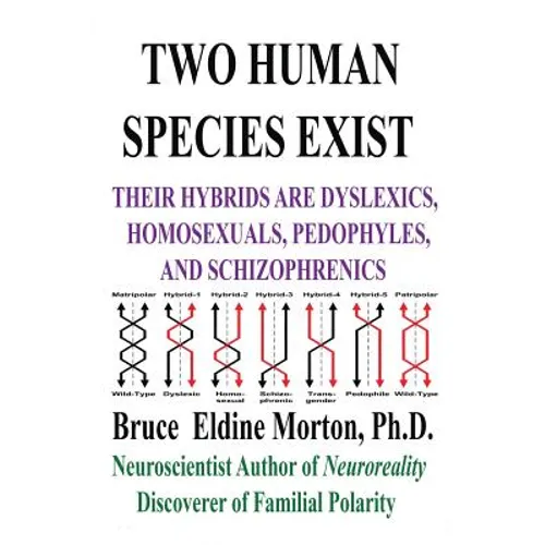 Two Human Species Exist: Their Hybrids Are Dylsexics, Homosexuals, Pedophiles, and Schizophrenics