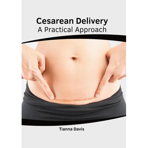 Cesarean Delivery: A Practical Approach
