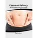 Cesarean Delivery: A Practical Approach