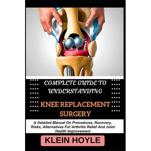 Complete Guide to Understanding Knee Replacement Surgery: A Detailed Manual On Procedures, Recovery, Risks, Alternatives For Arthritis Relief And Join