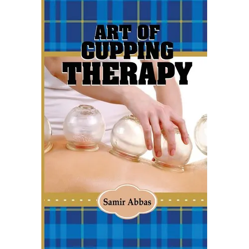 Art of Cupping Therapy