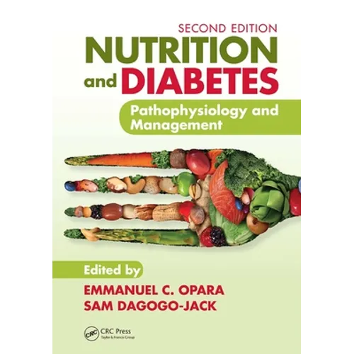 Nutrition and Diabetes: Pathophysiology and Management
