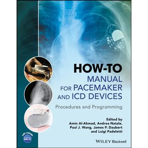How-To Manual for Pacemaker and ICD Devices: Procedures and Programming