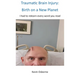 Traumatic Brain Injury: Birth on a New Planet