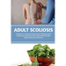 Adult Scoliosis: A Beginner's 2-Week Quick Start Guide on Managing Adult Scoliosis Through Diet and Other Natural Methods, With Sample Recipes and a M
