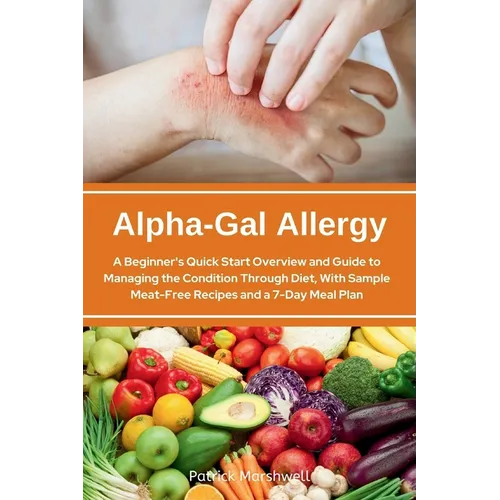Alpha-Gal Allergy: A Beginner's Quick Start Overview and Guide to Managing the Condition Through Diet, with Sample Meat-Free Recipes and