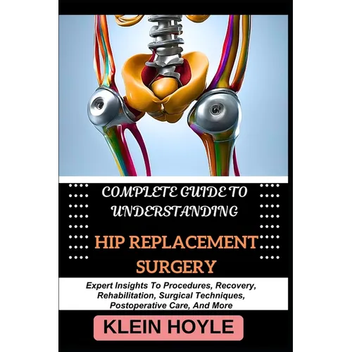 Complete Guide to Understanding Hip Replacement Surgery: Expert Insights To Procedures, Recovery, Rehabilitation, Surgical Techniques, Postoperative C