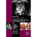 Cardiac MRI in Diagnosis, Clinical Management, and Prognosis of Arrhythmogenic Right Ventricular Cardiomyopathy/Dysplasia