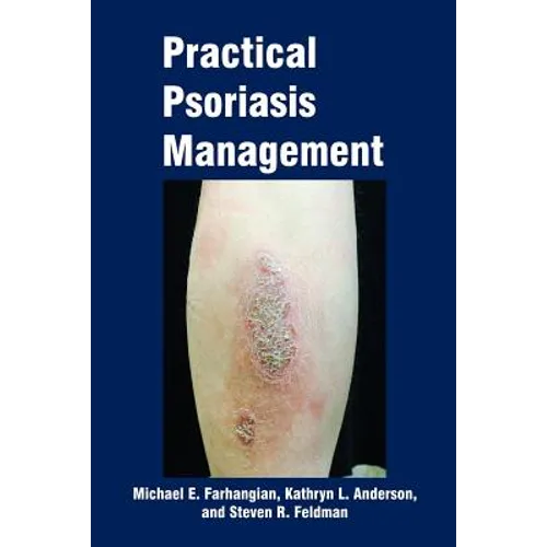 Practical Psoriasis Management
