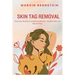 Skin Tag Removal: Discover the Key to Achieving Radiant, Youthful Skin the Natural Way