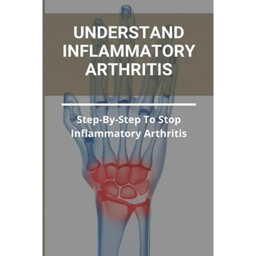 Understand Inflammatory Arthritis: Step-By-Step To Stop Inflammatory Arthritis: Unusual Symptoms Of Rheumatoid Arthritis