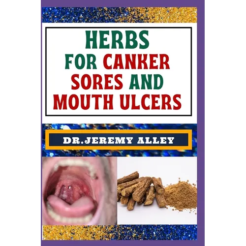 Herbs for Canker Sores and Mouth Ulcers: Soothing Remedies, Harnessing Wisdom To Relieve Nature's Bounty Through Effective Strategies