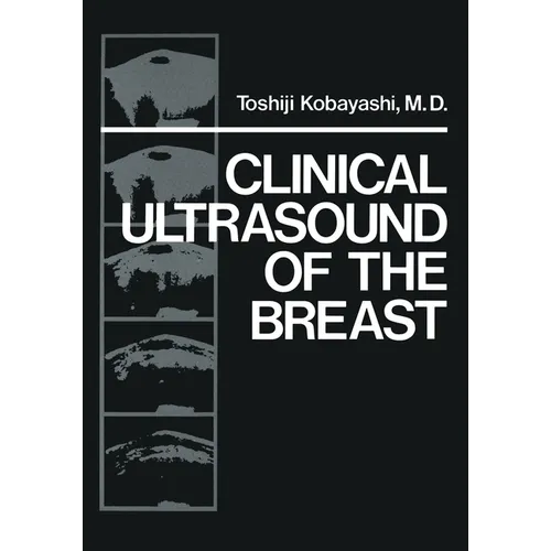 Clinical Ultrasound of the Breast