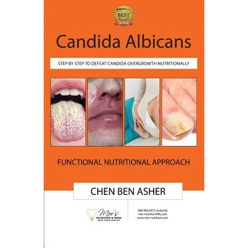 Candida Albicans: Step by Step to Defeat Candida Overgrowth Nutritionally