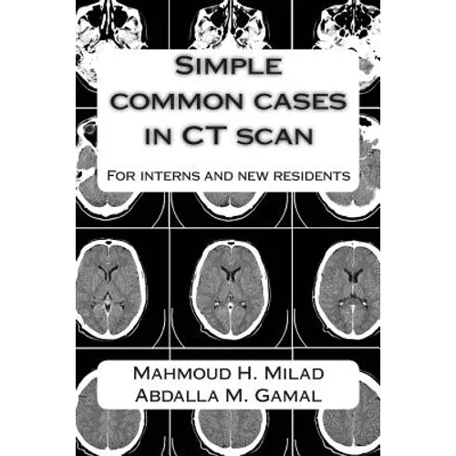 Simple common cases in CT scan: For interns and new residents