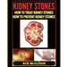 Kidney Stones: How To Treat Kidney Stones: How To Prevent Kidney Stones