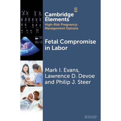 Fetal Compromise in Labor