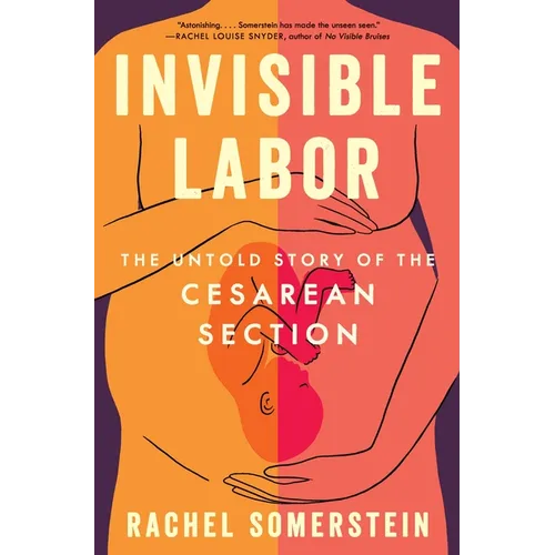Invisible Labor: The Untold Story of the Cesarean Section