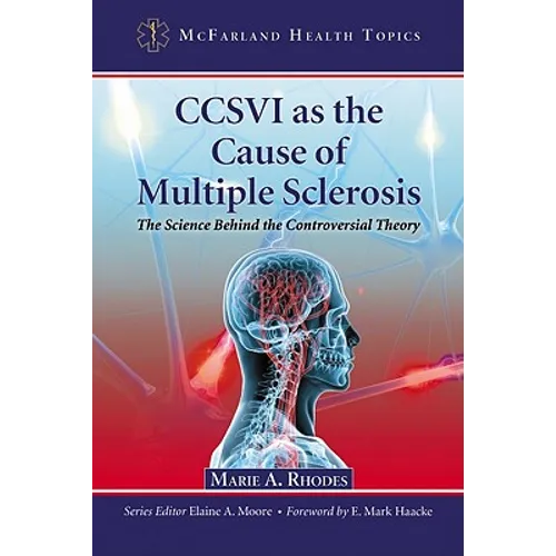 CCSVI as the Cause of Multiple Sclerosis: The Science Behind the Controversial Theory