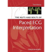 The Nuts and Bolts of Paced ECG Interpretation