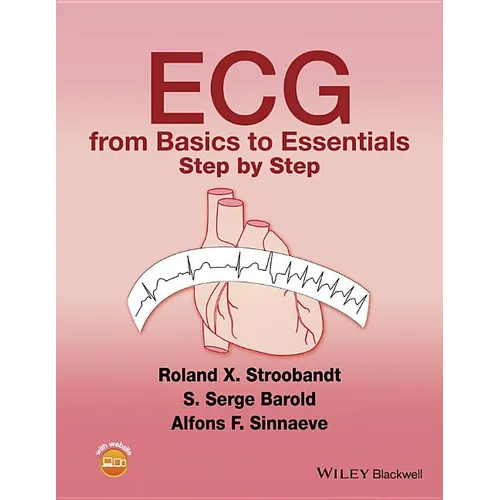 ECG from Basics to Essentials