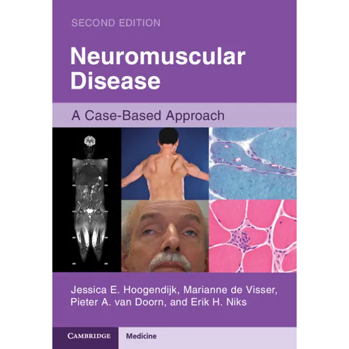 Neuromuscular Disease