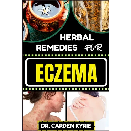 Herbal Remedies for Eczema: Unlocking Nature's Healing Power With Herbs For Flourishing Skin, Holistic Wellness, Lasting Relief And Healthy Lifestyle