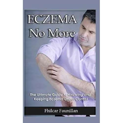 Eczema Cure: Eczema No More - The Ultimate Guide to Knowing and Keeping Eczema Under Control