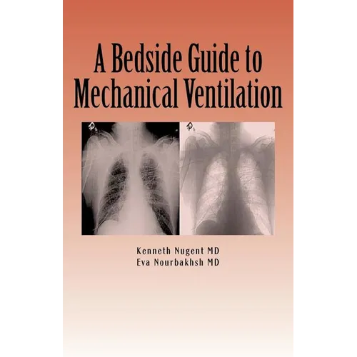 A Bedside Guide to Mechanical Ventilation