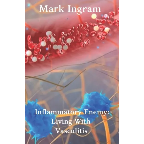 Inflammatory Enemy: Living With Vasculitis