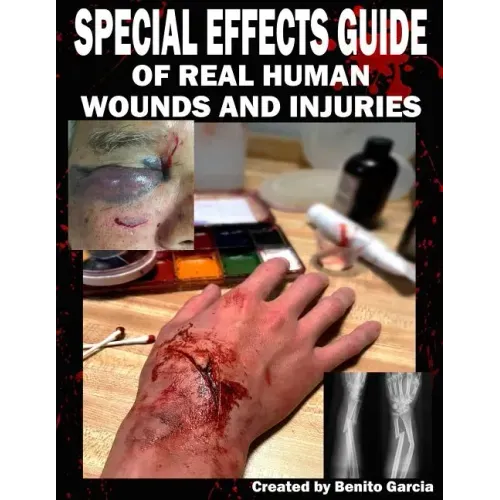 Special Effects Guide Of Real Human Wounds and Injuries: Special Effects Guide Of Real Human Wounds and Injuries