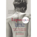 Lupus Q & A: Everything You Need to Know