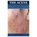 The Acene: (The Acne Cure And Maintainers) Just Another Four Letter Words
